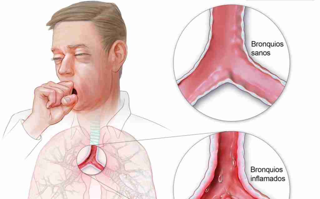 crystals for lung